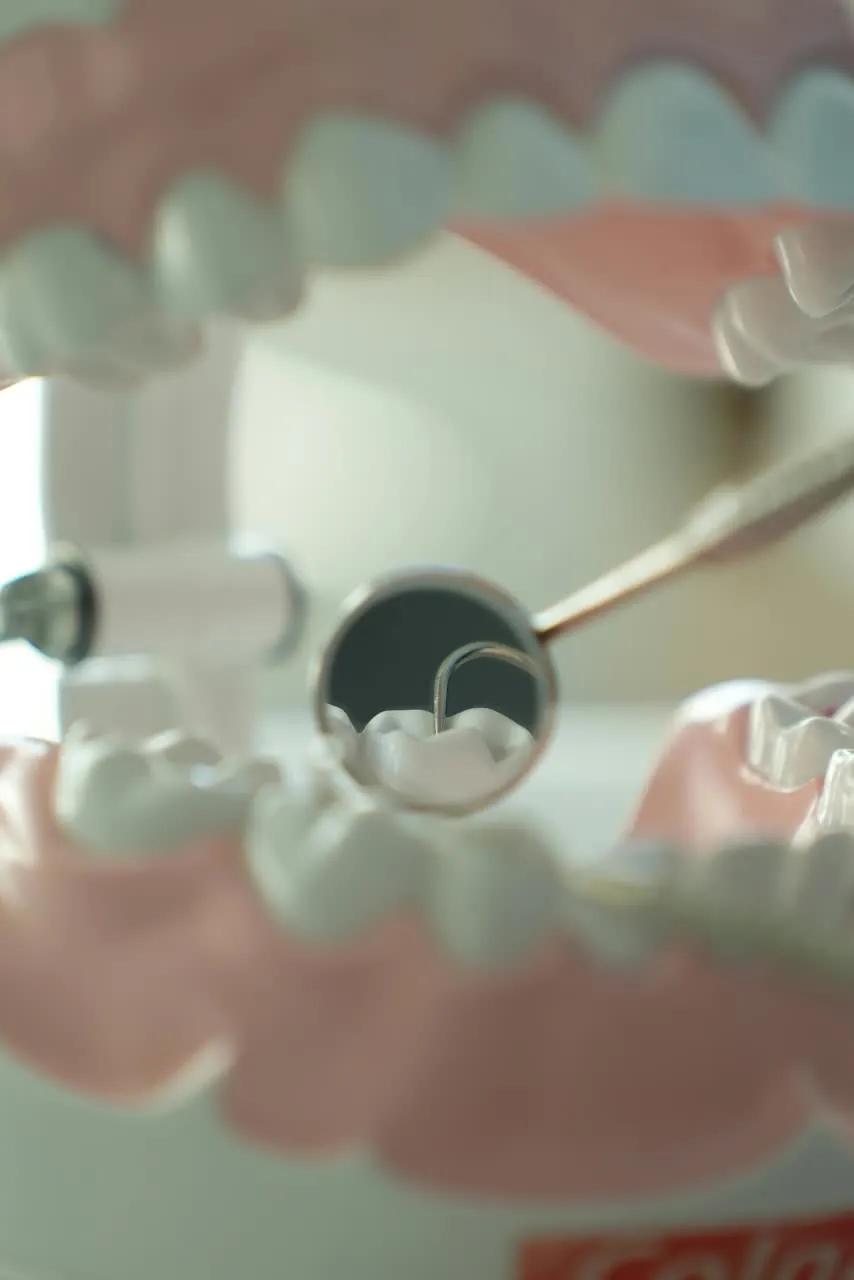 Dental Fillings